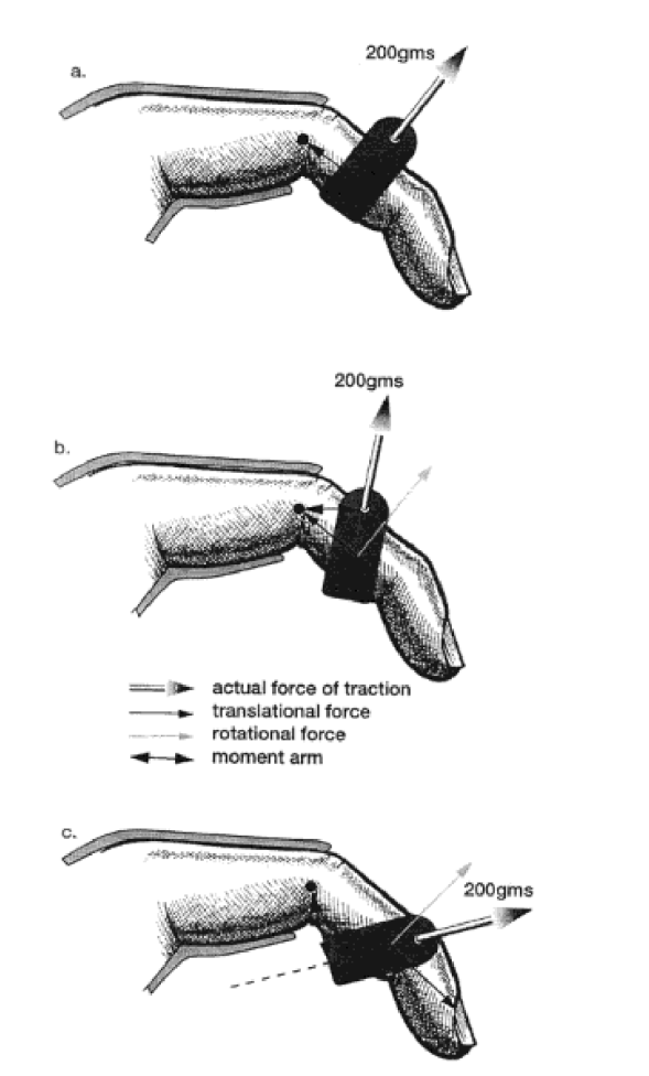 Thumbnail Image 1